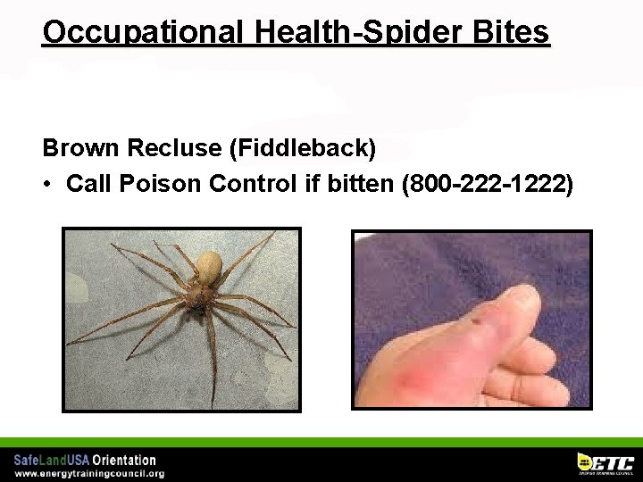 Occupational Health-Spider Bites Brown Recluse (Fiddleback) • Call Poison Control if bitten (800 -222