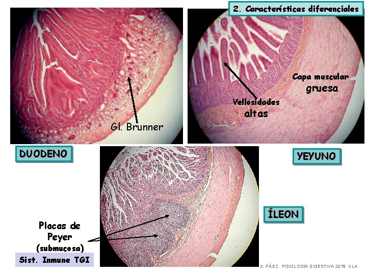 2. Características diferenciales Capa muscular gruesa Vellosidades Gl. Brunner DUODENO Placas de Peyer (submucosa)