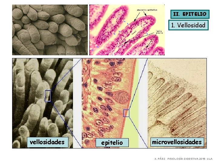 II. EPITELIO 1. Vellosidad vellosidades epitelio microvellosidades X. PÁEZ FISIOLOGÍA DIGESTIVA 2018 ULA 