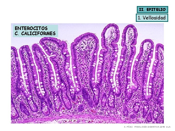 II. EPITELIO 1. Vellosidad ENTEROCITOS C. CALICIFORMES X. PÁEZ FISIOLOGÍA DIGESTIVA 2018 ULA 