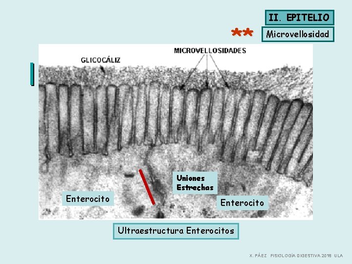 ** Enterocito II. EPITELIO Microvellosidad Uniones Estrechas Enterocito Ultraestructura Orla en cepillo Ultraestructura Enterocitos