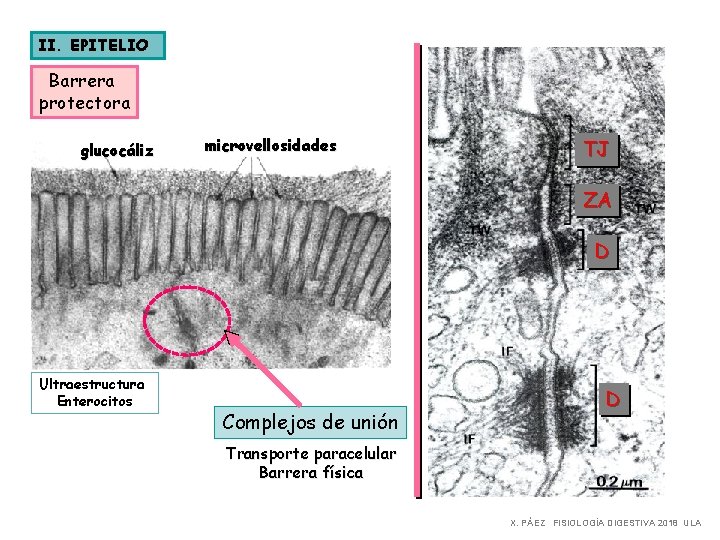 II. EPITELIO Barrera protectora glucocáliz microvellosidades TJ ZA D Ultraestructura Enterocitos Complejos de unión