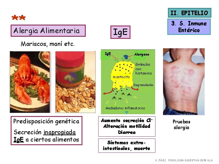 II. EPITELIO ** Alergia Alimentaria 3. S. Inmune Entérico Ig. E Mariscos, maní etc.
