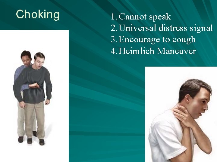 Choking 1. Cannot speak 2. Universal distress signal 3. Encourage to cough 4. Heimlich