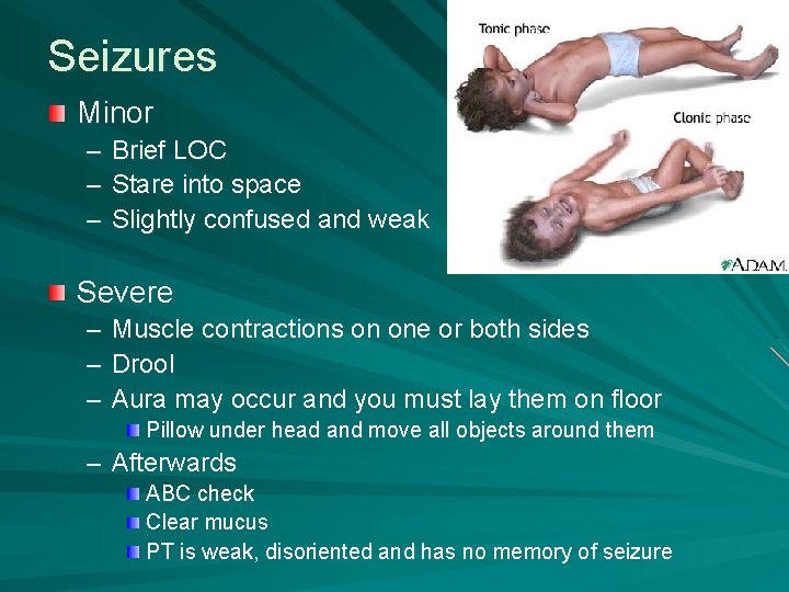 Seizures Minor – – – Brief LOC Stare into space Slightly confused and weak