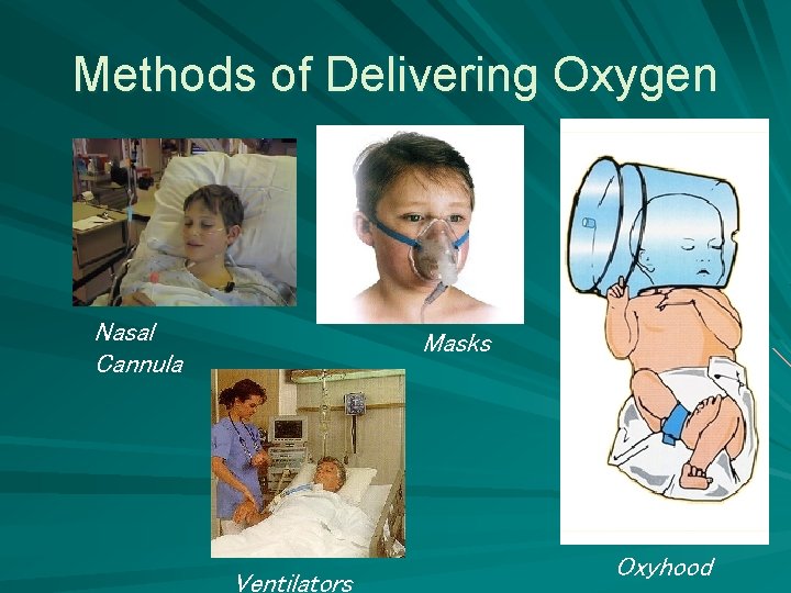 Methods of Delivering Oxygen Nasal Cannula Masks Ventilators Oxyhood 