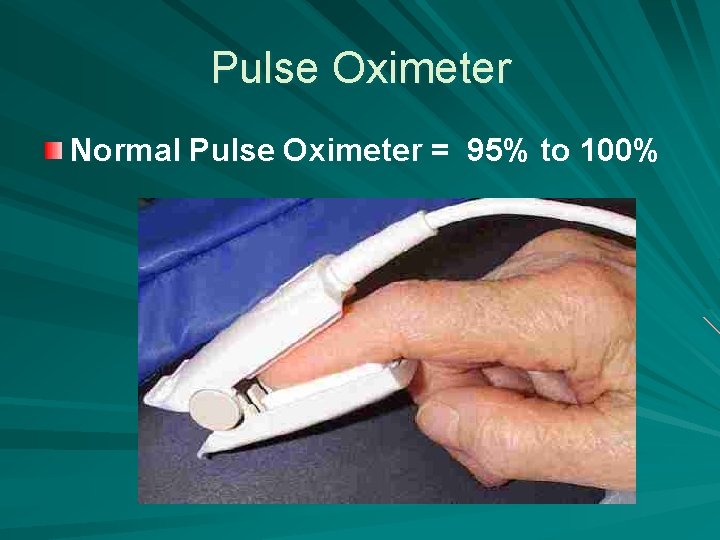 Pulse Oximeter Normal Pulse Oximeter = 95% to 100% 