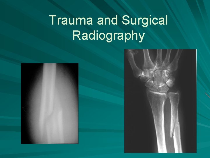 Trauma and Surgical Radiography 