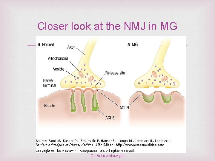 Closer look at the NMJ in MG Dr. Nuha Alkhawajah 