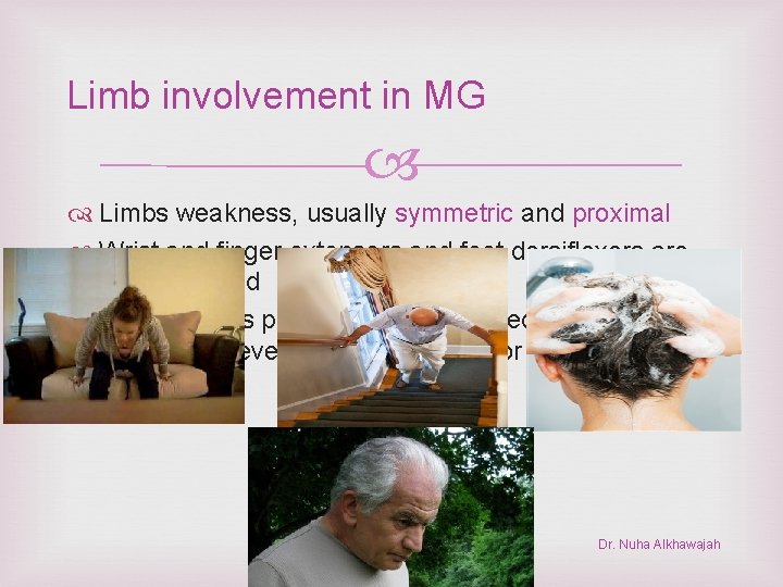 Limb involvement in MG Limbs weakness, usually symmetric and proximal Wrist and finger extensors