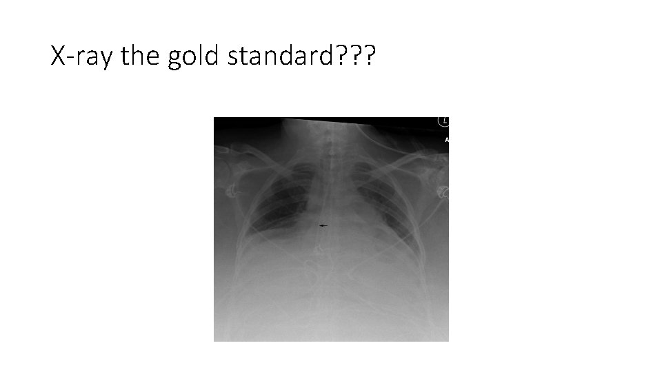 X-ray the gold standard? ? ? 
