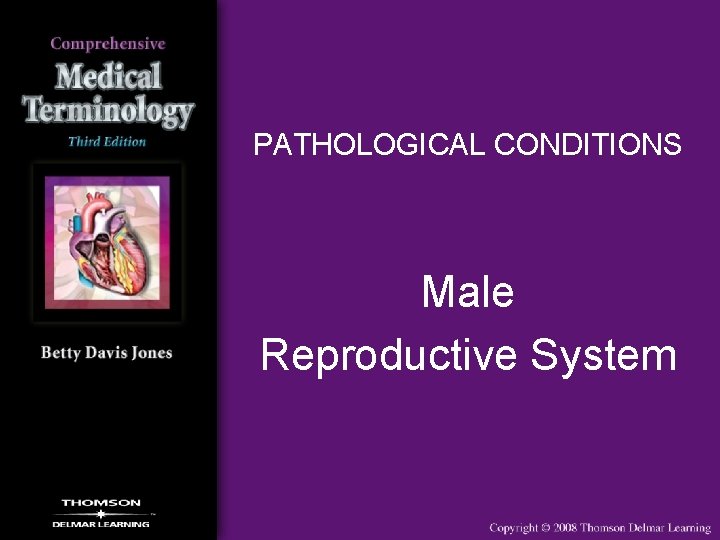 PATHOLOGICAL CONDITIONS Male Reproductive System 