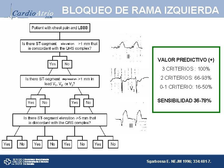 BLOQUEO DE RAMA IZQUIERDA elevation VALOR PREDICTIVO (+) 3 CRITERIOS : 100% depression 2