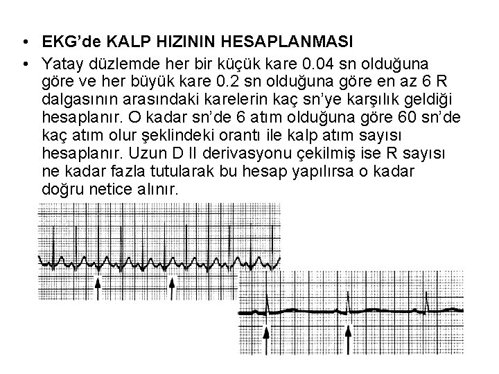  • EKG’de KALP HIZININ HESAPLANMASI • Yatay düzlemde her bir küçük kare 0.