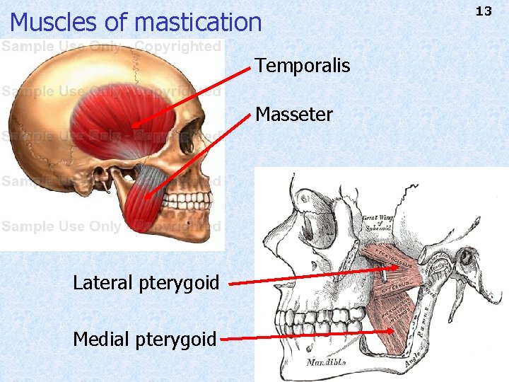 Muscles of mastication Temporalis Masseter Lateral pterygoid Medial pterygoid 13 