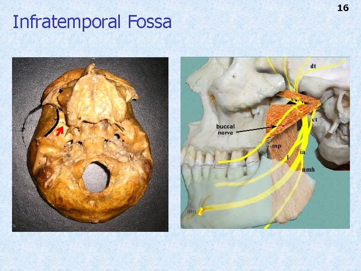 Infratemporal Fossa 16 