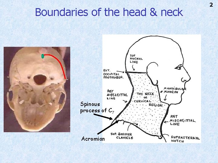 Boundaries of the head & neck Spinous process of C 7 Acromian 2 