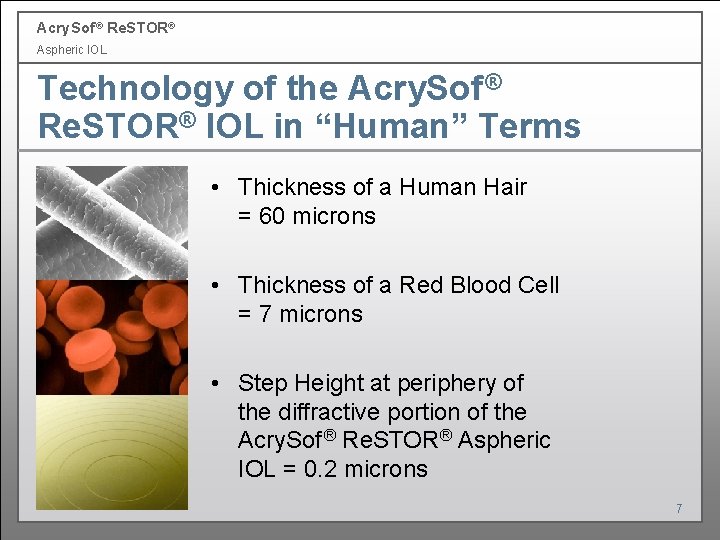 Acry. Sof ® Re. STOR® Aspheric IOL Technology of the Acry. Sof ® Re. Acry. Sof ® Re. STOR® Aspheric IOL Technology of the Acry. Sof ® Re.