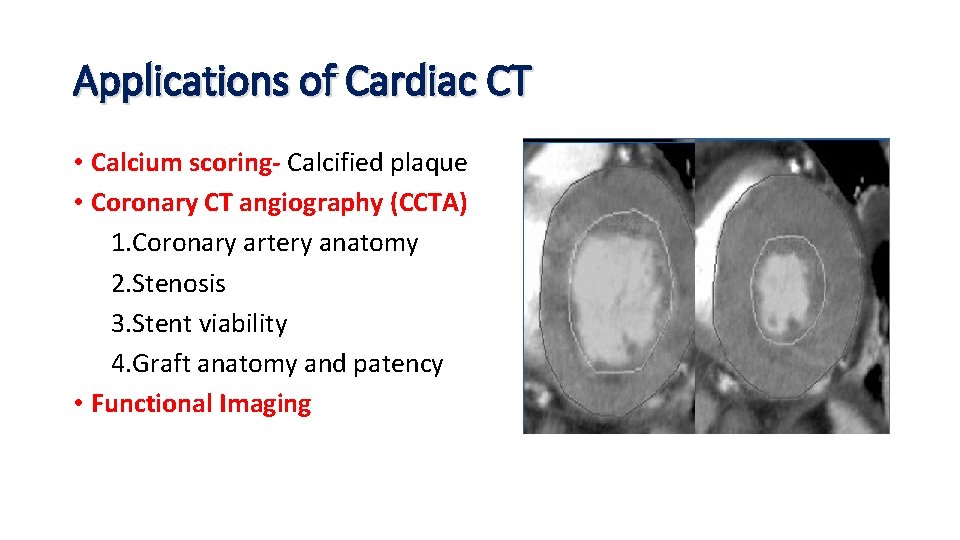 Applications of Cardiac CT • Calcium scoring- Calcified plaque • Coronary CT angiography (CCTA)