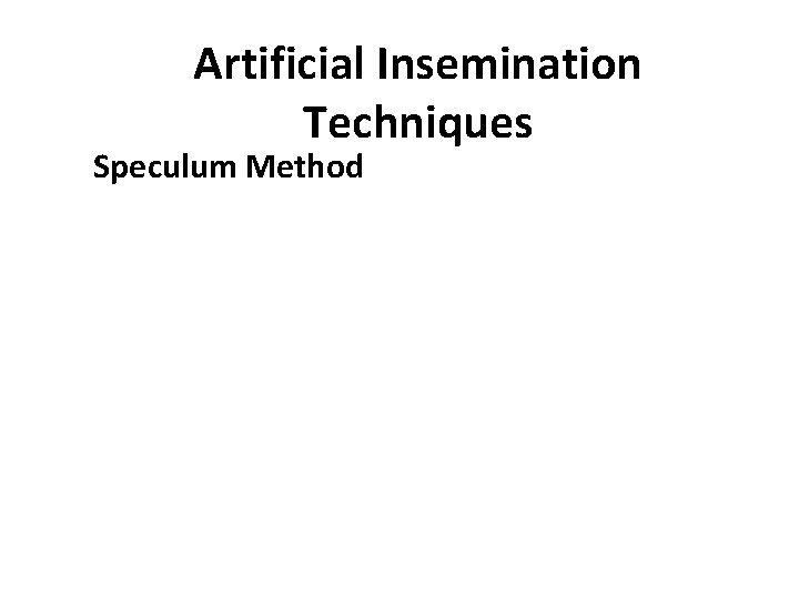 Artificial Insemination Techniques Speculum Method 