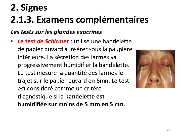 2. Signes 2. 1. 3. Examens complémentaires Les tests sur les glandes exocrines •