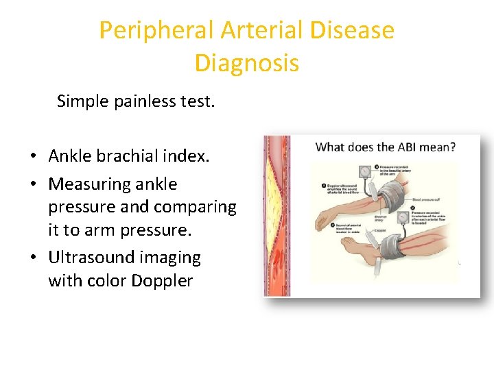 Peripheral Arterial Disease Diagnosis Simple painless test. • Ankle brachial index. • Measuring ankle