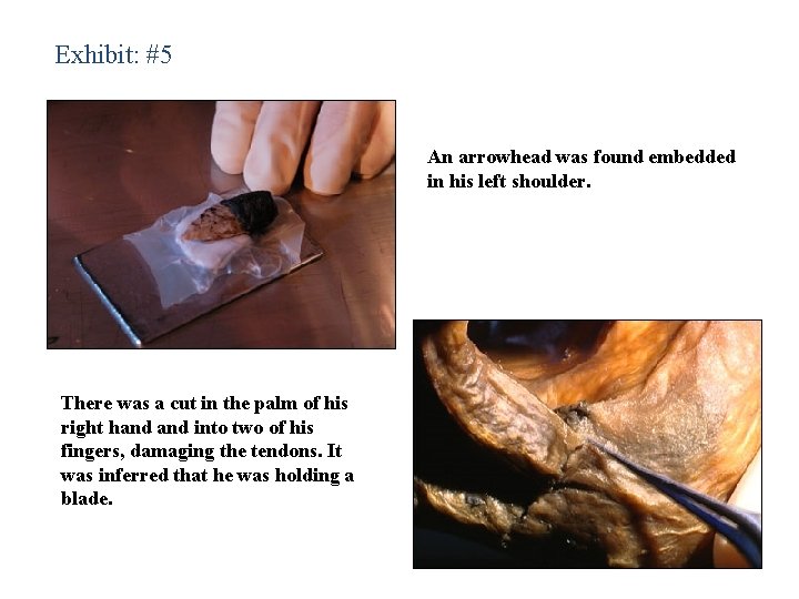 Exhibit: #5 An arrowhead was found embedded in his left shoulder. There was a