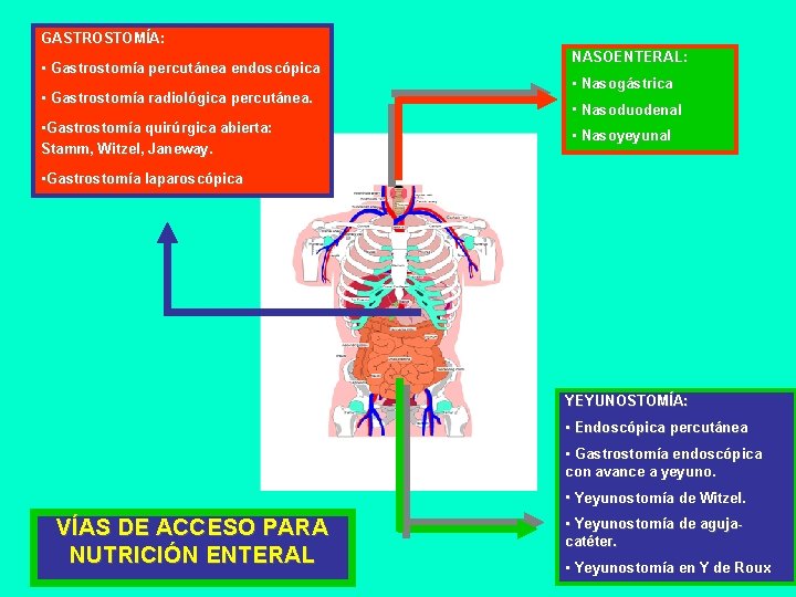 GASTROSTOMÍA: • Gastrostomía percutánea endoscópica • Gastrostomía radiológica percutánea. • Gastrostomía quirúrgica abierta: Stamm,