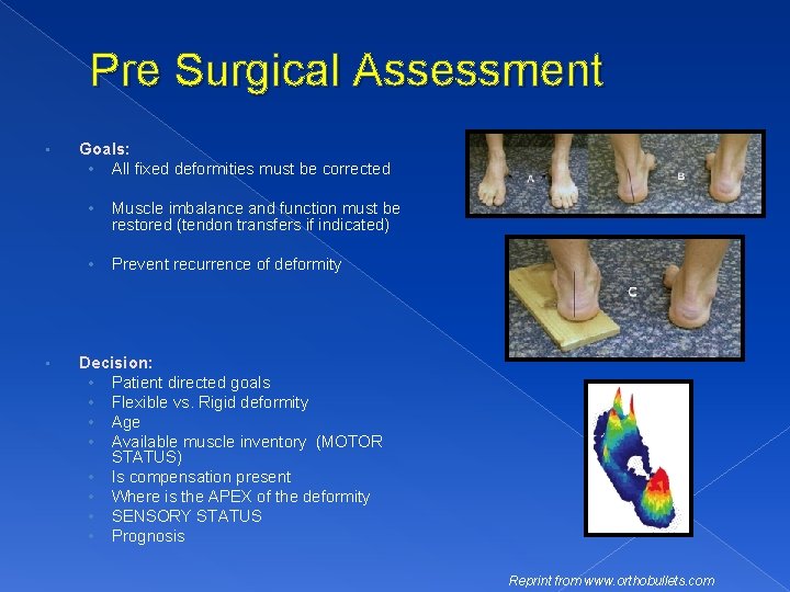 Pre Surgical Assessment • • Goals: • All fixed deformities must be corrected •