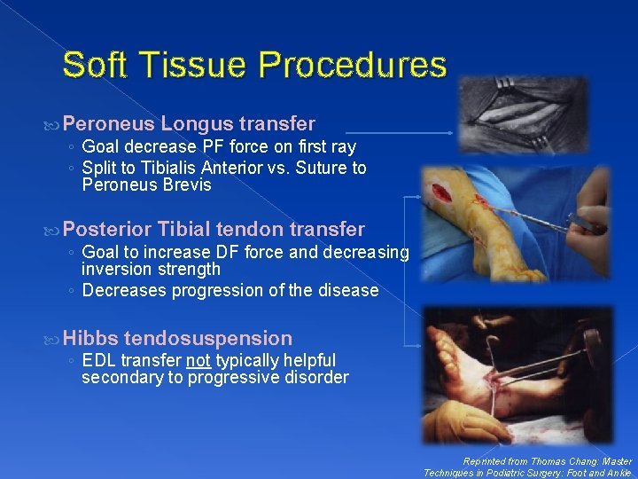 Soft Tissue Procedures Peroneus Longus transfer ◦ Goal decrease PF force on first ray