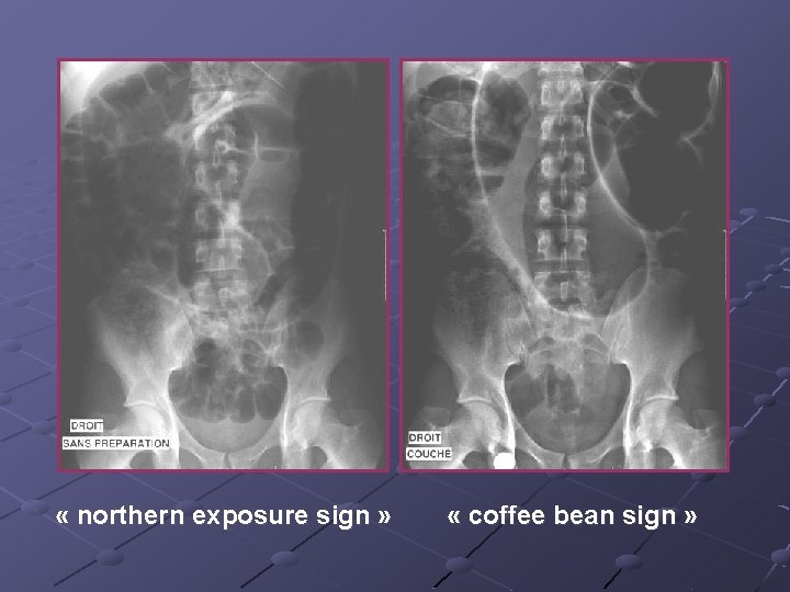  « northern exposure sign » « coffee bean sign » 