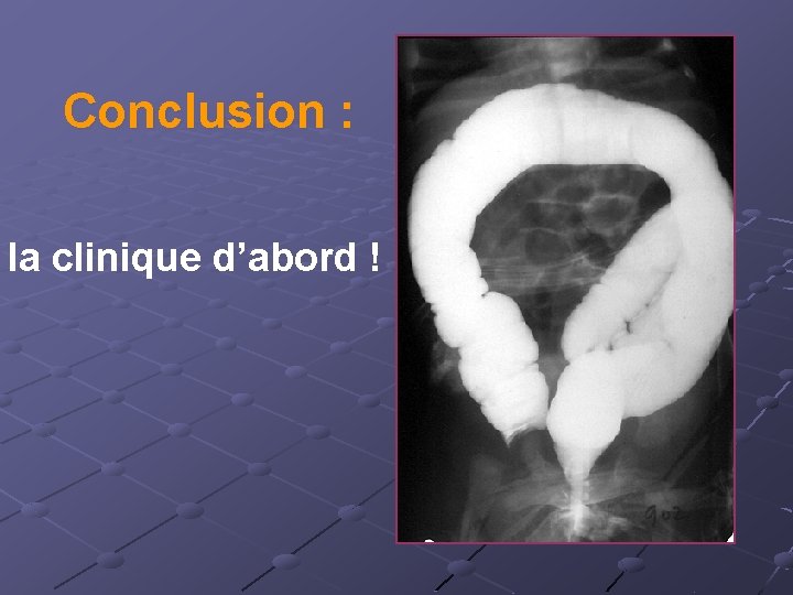 Conclusion : la clinique d’abord ! 