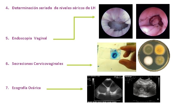 4. Determinación seriada de niveles séricos de LH 5. Endoscopia Vaginal 6. Secreciones Cervicovaginales