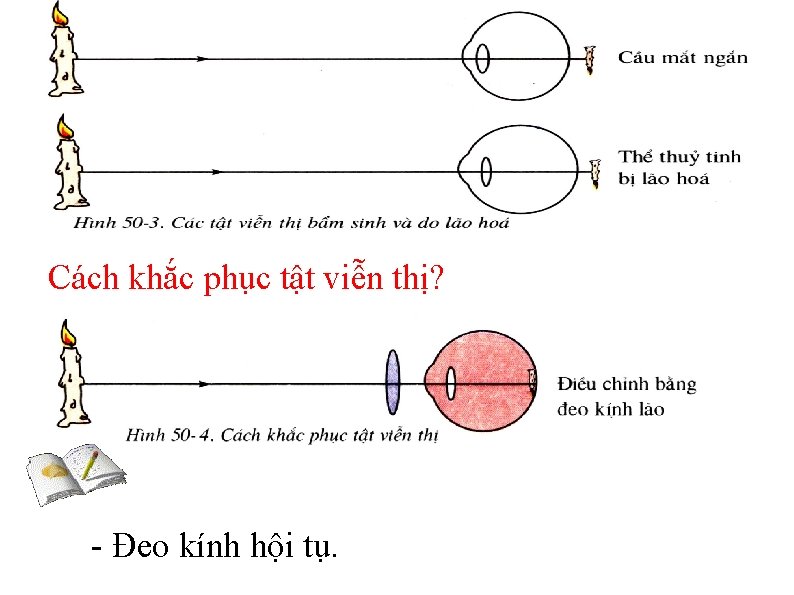 Cách khắc phục tật viễn thị? - Đeo kính hội tụ. 