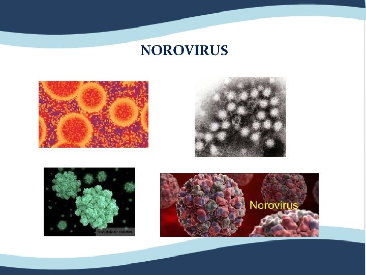 NOROVIRUS 