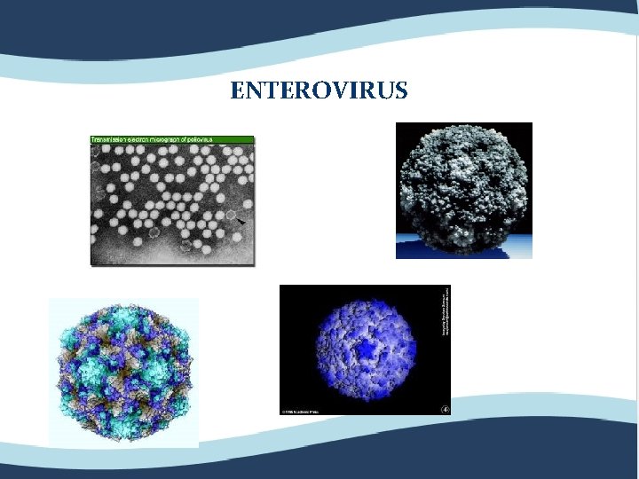 ENTEROVIRUS 