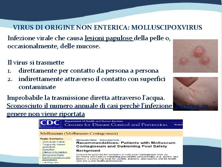 VIRUS DI ORIGINE NON ENTERICA: MOLLUSCIPOXVIRUS Infezione virale che causa lesioni papulose della pelle