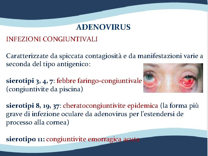 ADENOVIRUS INFEZIONI CONGIUNTIVALI Caratterizzate da spiccata contagiosità e da manifestazioni varie a seconda del