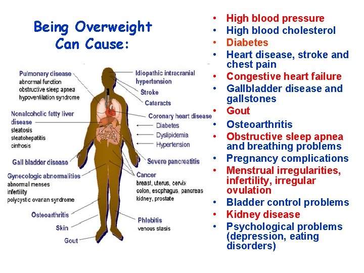 Being Overweight Can Cause: • • • • High blood pressure High blood cholesterol