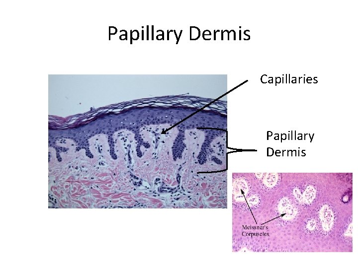 Papillary Dermis Capillaries Papillary Dermis 