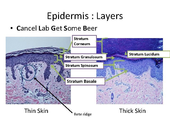 Epidermis : Layers • Cancel Lab Get Some Beer Stratum Corneum Stratum Granulosum Stratum