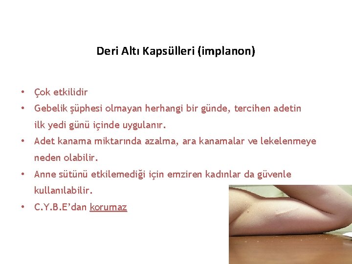 Deri Altı Kapsülleri (implanon) • Çok etkilidir • Gebelik şüphesi olmayan herhangi bir günde,