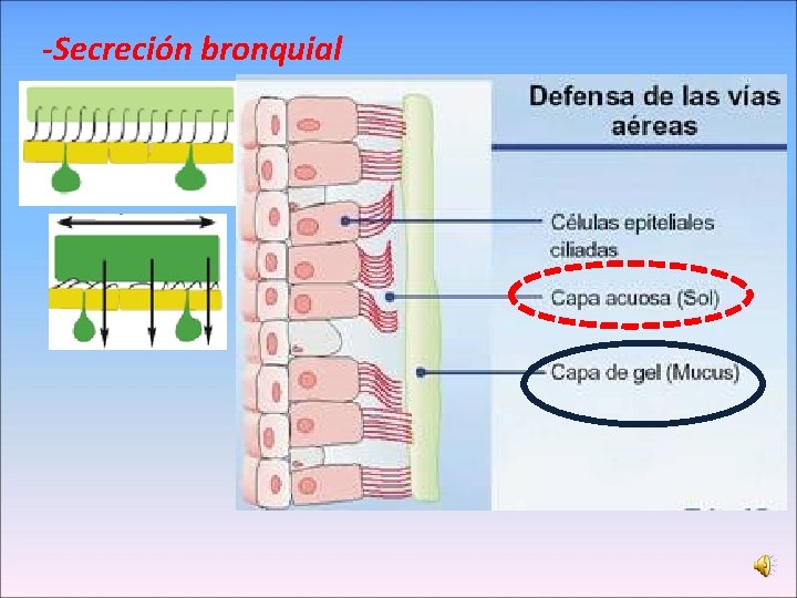 -Secreción bronquial 