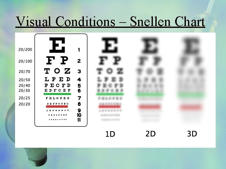 Visual Conditions – Snellen Chart 