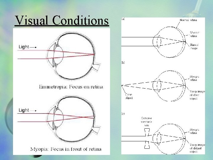 Visual Conditions 