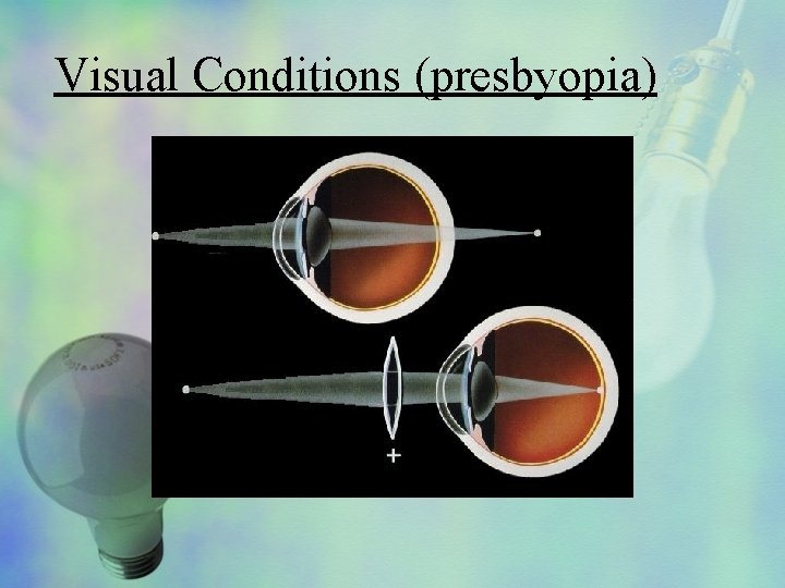 Visual Conditions (presbyopia) 