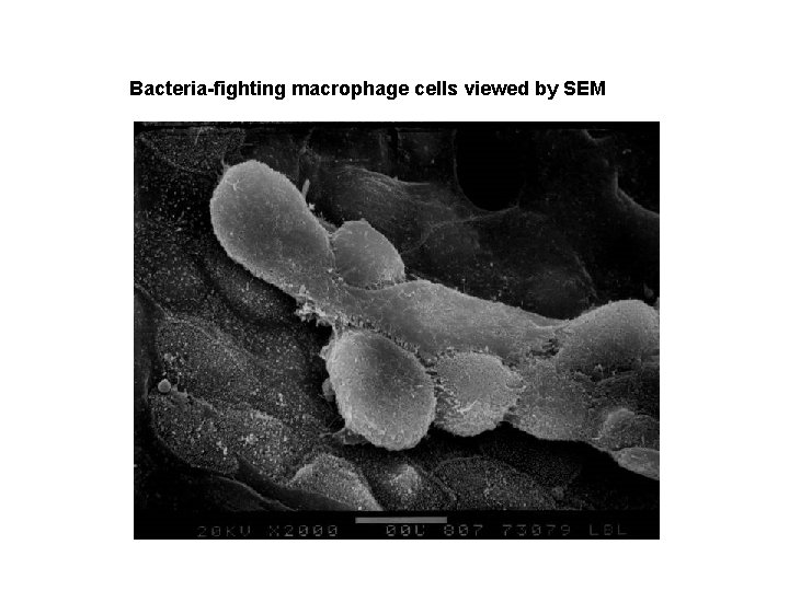 Bacteria-fighting macrophage cells viewed by SEM 