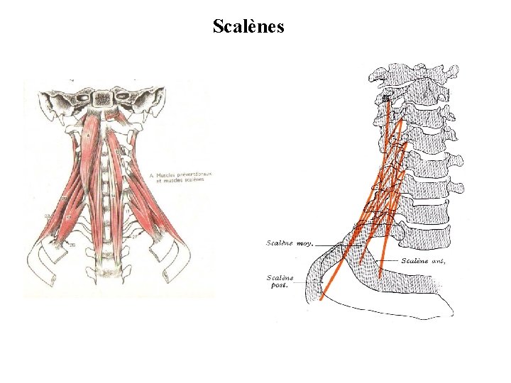 Scalènes 