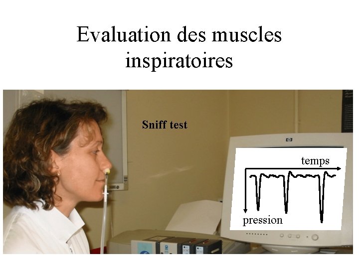 Evaluation des muscles inspiratoires Sniff test temps pression 