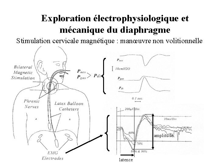 Exploration électrophysiologique et mécanique du diaphragme Stimulation cervicale magnétique : manœuvre non volitionnelle amplitude